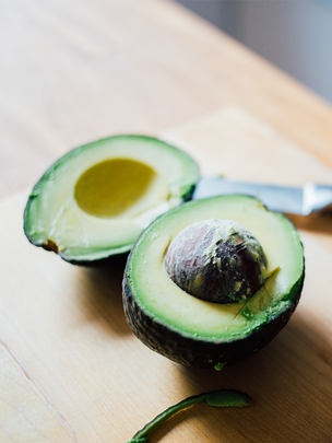 Conseils botanic® Tout savoir sur l'avocat, un fruit pas comme les autres